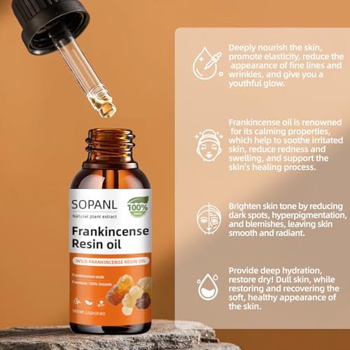 Organic Frankincense Resin Oil for Face - Reduces Fine Lines & Wrinkles, Soothes Irritated Skin, Deep Hydration for All Skin Types, Daily Skincare, 2 Fl Oz Avelisse