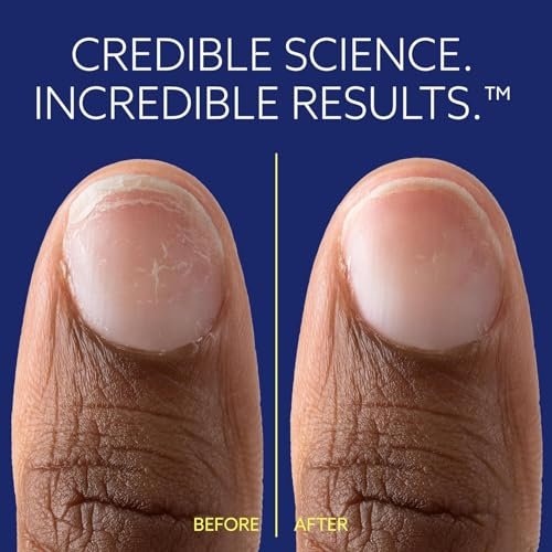 ePhD Bond Repair Nail Treatment – Strengthen, Restore & Rebuild Brittle Nails from Within – Clear Formula for Damaged or Post-Gel Nails, Use Alone or as Polish Base - görsel 8