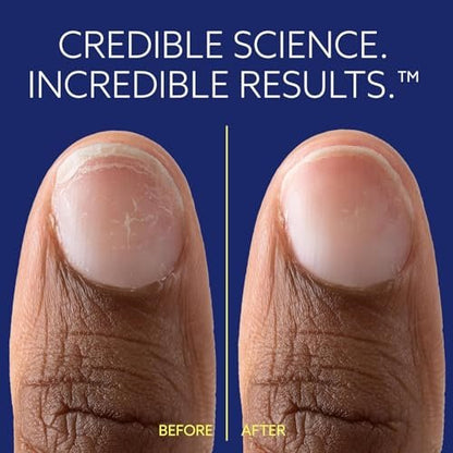 ePhD Bond Repair Nail Treatment – Strengthen, Restore & Rebuild Brittle Nails from Within – Clear Formula for Damaged or Post-Gel Nails, Use Alone or as Polish Base