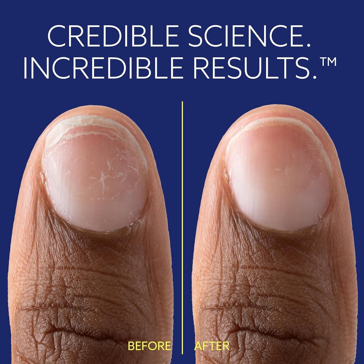 ePhD Bond Repair Nail Treatment – Strengthen, Restore & Rebuild Brittle Nails from Within – Clear Formula for Damaged or Post-Gel Nails, Use Alone or as Polish Base - görsel 7