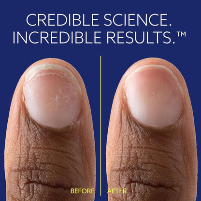 ePhD Bond Repair Nail Treatment – Strengthen, Restore & Rebuild Brittle Nails from Within – Clear Formula for Damaged or Post-Gel Nails, Use Alone or as Polish Base