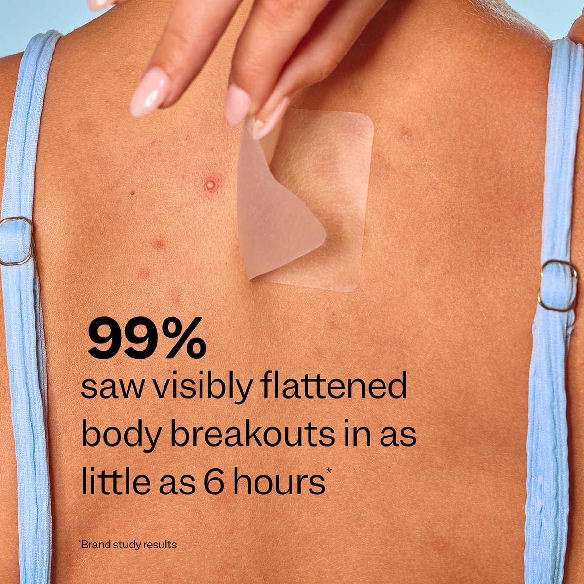 Peach Slices Body Breakout Patches (6 ct) - Overnight Body Pimple Patches - Hypoallergenic Cica & Hydrocolloid Bandages - Vegan & Cruelty Free Korean Skin Care - görsel 9