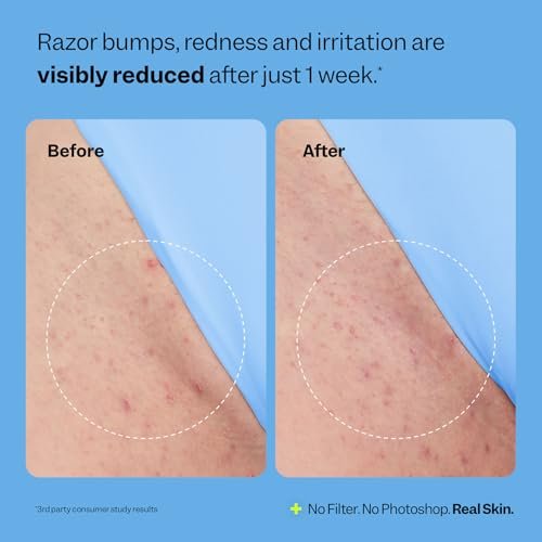 Peach Slices Smoothing Solution Ingrown Hair Treatment - 1.69 oz - BHA, AHA, PHA, Niacinamide, Licorice - Vegan & Cruelty Free - Korean Skin Care Avelisse