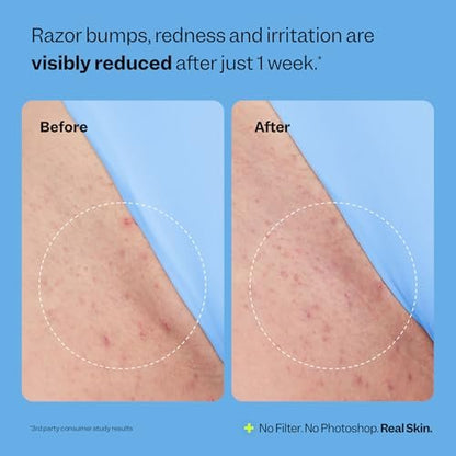 Peach Slices Smoothing Solution Ingrown Hair Treatment - 1.69 oz - BHA, AHA, PHA, Niacinamide, Licorice - Vegan & Cruelty Free - Korean Skin Care Avelisse