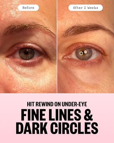 PEACE OUT Retinol Eye Jelly Stick - Hydrating Under Eye Treatment for Fine Lines & Wrinkles with Encapsulated Retinol, Peptides & Squalane (0.14 oz) Avelisse
