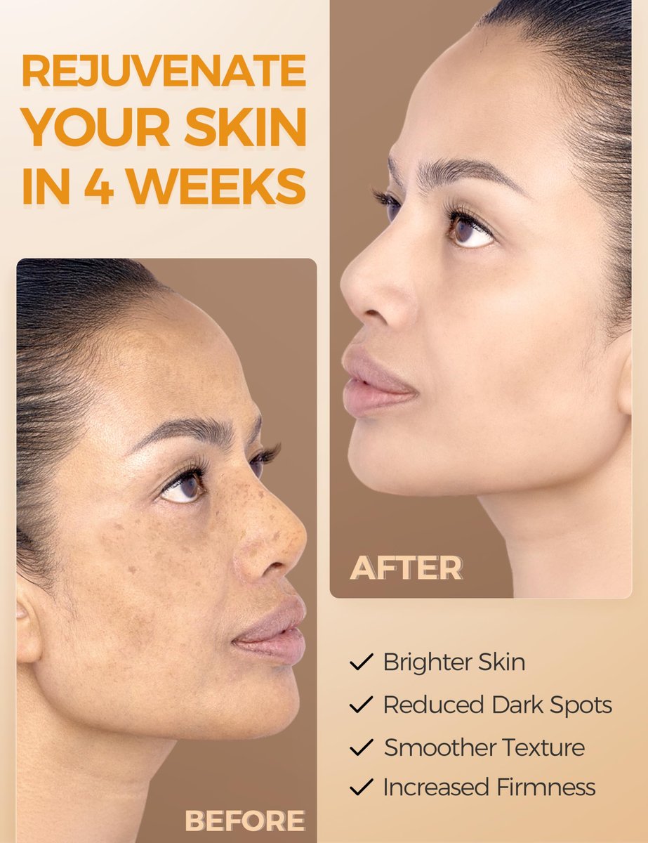 NING DERMOLOGIE Vitamin C Serum with Niacinamide & Ethyl Ascorbic Acid: Brightening, Moisturizing Face Serum for Dark Spots, Hyperpigmentation & Anti-Aging Treatment | Korean Synergy Formula 1.01oz Avelisse