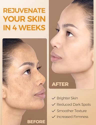 NING DERMOLOGIE Vitamin C Serum with Niacinamide & Ethyl Ascorbic Acid: Brightening, Moisturizing Face Serum for Dark Spots, Hyperpigmentation & Anti-Aging Treatment | Korean Synergy Formula 1.01oz Avelisse