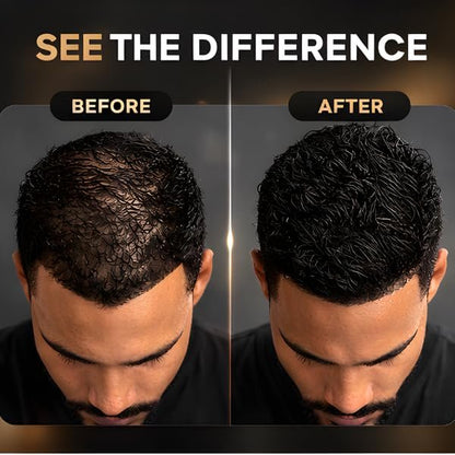 Hair Thickening Fibers (Black) + Fiber Locking Spray & Applicator Pump – Natural Fuller Hair & Beard Set by THE MAN KIT Avelisse