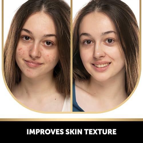 VALITIC Salicylic Acid & Vitamin C Soap Bar 2-Pack – Exfoliating Face & Body Wash for Blackheads, Pores & Blemish-Prone Skin with Collagen, Hyaluronic Acid, Vitamin E Avelisse