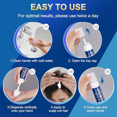 5% Minoxidil Foam for Men with Biotin - 5 Pack, Hair Growth Treatment for Thicker, Fuller Hair & Beard (10.5 oz, 5 Month Supply) Avelisse