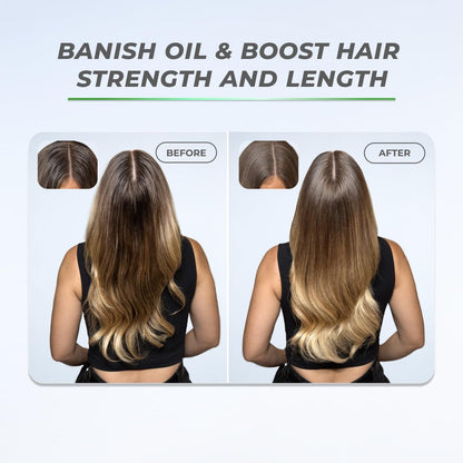 XMONDO Hair BOOST X Dry Shampoo – Zero Residue, Scalp Care with Saw Palmetto, Talc-Free, 5 oz Avelisse