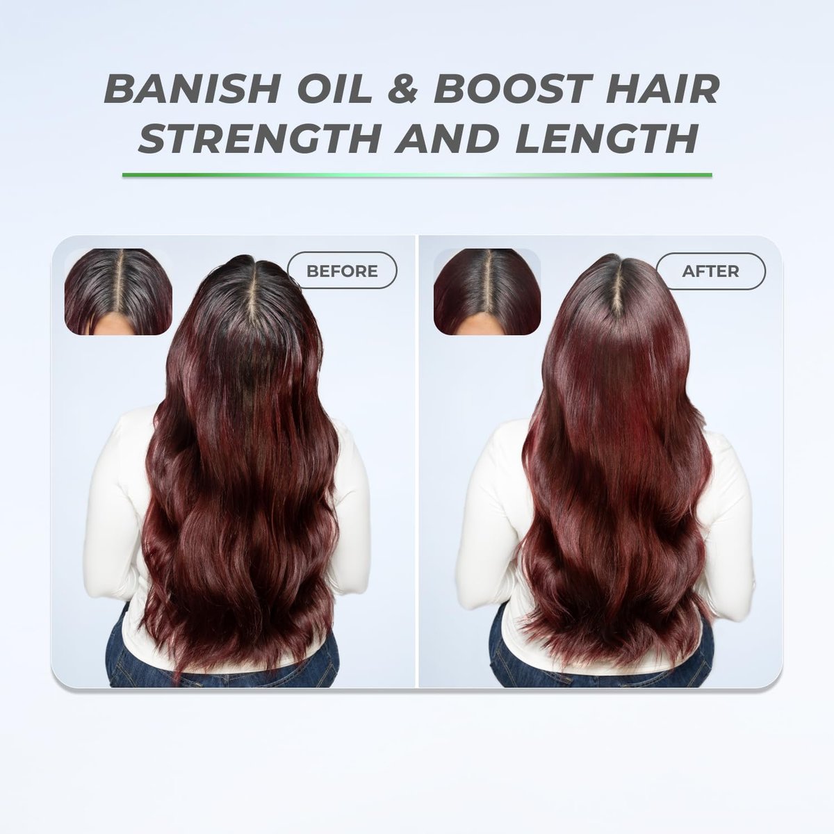 XMONDO Hair BOOST X Dry Shampoo – Zero Residue, Scalp Care with Saw Palmetto, Talc-Free, 5 oz Avelisse