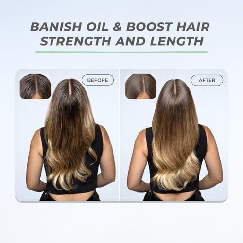 XMONDO Hair BOOST X Dry Shampoo – Zero Residue, Scalp Care with Saw Palmetto, Talc-Free, 5 oz Avelisse
