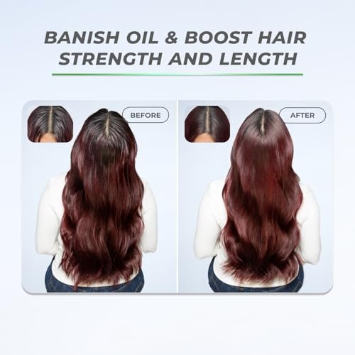 XMONDO Hair BOOST X Dry Shampoo – Zero Residue, Scalp Care with Saw Palmetto, Talc-Free, 5 oz Avelisse
