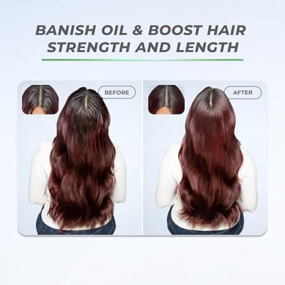 XMONDO Hair BOOST X Dry Shampoo – Zero Residue, Scalp Care with Saw Palmetto, Talc-Free, 5 oz Avelisse