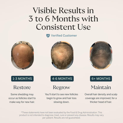 Happy Head Hair Serum for Men & Women – Procapil, Biotin, Ashwagandha & Collagen Leave-In Scalp Treatment for Daily Hair Care, Lightweight 2 Oz Bottle Avelisse