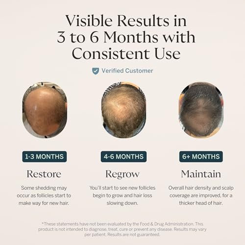 Happy Head Hair Serum for Men & Women – Procapil, Biotin, Ashwagandha & Collagen Leave-In Scalp Treatment for Daily Hair Care, Lightweight 2 Oz Bottle Avelisse