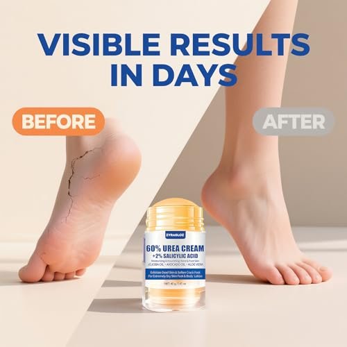 Urea Cream Stick 60% + 2% Salicylic Acid, 2-Pack Maximum Strength Foot Lotion for Cracked Heels, Dry Hands & Rough Knees, Callus Remover & Skin Softener - görsel 8