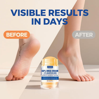 Urea Cream Stick 60% + 2% Salicylic Acid, 2-Pack Maximum Strength Foot Lotion for Cracked Heels, Dry Hands & Rough Knees, Callus Remover & Skin Softener