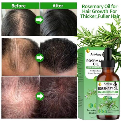 3 Pack Rosemary Oil for Hair Growth, Strengthening Oil for Dry Damaged Hair, Hair Loss Treatment & Thickens Hair, Scalp Care Promotes Hair Thickness for Men Women