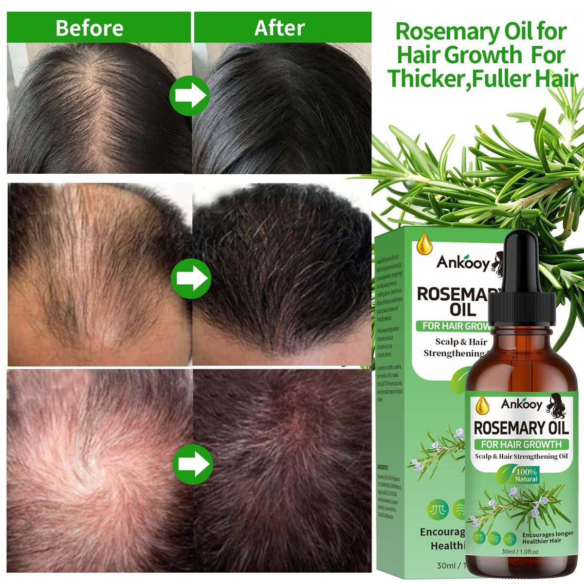 3 Pack Rosemary Oil for Hair Growth, Strengthening Oil for Dry Damaged Hair, Hair Loss Treatment & Thickens Hair, Scalp Care Promotes Hair Thickness for Men Women - görsel 5
