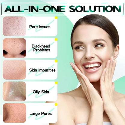 SYABO 2.0 Blackhead Remover Nose Strips – 100 Pcs Pore Cleanser with Salicylic Acid, Upgraded Peel Off Mask for Blackheads Removal (1.76 oz) Avelisse