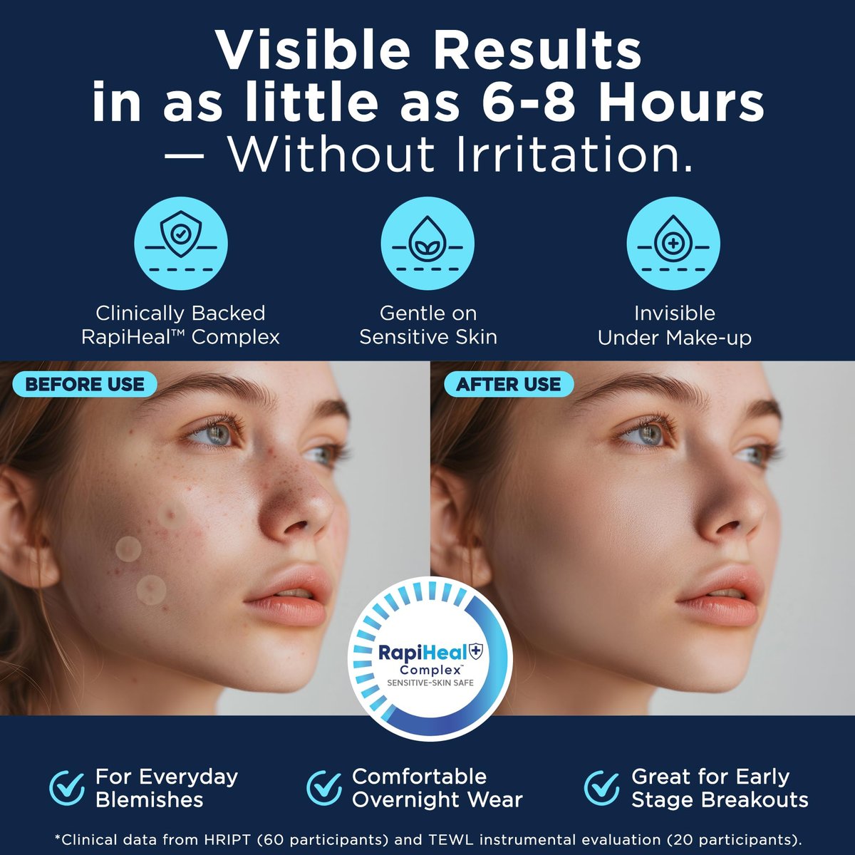 Dura Cleanse Pimple Patches for Face - 134 Count Hydrocolloid Acne Patches, Zit & Blemish Dots, Invisible Clear Stickers for Forehead, Chin, Nose, 3 Sizes (S, M, L) Avelisse