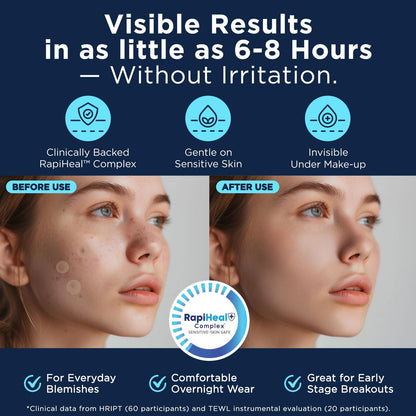 Dura Cleanse Pimple Patches for Face - 134 Count Hydrocolloid Acne Patches, Zit & Blemish Dots, Invisible Clear Stickers for Forehead, Chin, Nose, 3 Sizes (S, M, L) Avelisse