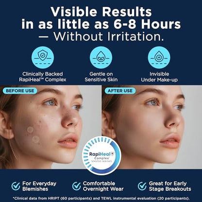 Dura Cleanse Pimple Patches for Face - 134 Count Hydrocolloid Acne Patches, Zit & Blemish Dots, Invisible Clear Stickers for Forehead, Chin, Nose, 3 Sizes (S, M, L) Avelisse