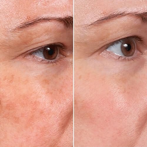 MSGBcg Ageless Rejuvenate Face Serum (Pack of 3) - Anti Wrinkle Firming Serum with 12% Vitamin C & 1% Hyaluronic Acid for All Skin Types Avelisse