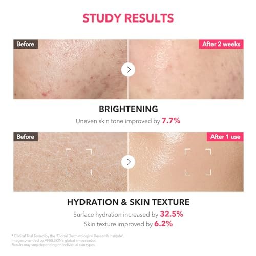 APRILSKIN TXA+Niacinamide 99 Pink Milky Toner | 99% High-Purity TXA 3% + Niacinamide 5% for Brightening | Highly Concentrated Cream Toner | Deep Moisturizing Formula for Dull Skin | 5.07 fl.oz. - görsel 10
