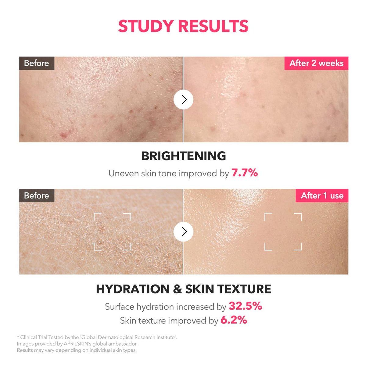APRILSKIN TXA+Niacinamide 99 Pink Milky Toner | 99% High-Purity TXA 3% + Niacinamide 5% for Brightening | Highly Concentrated Cream Toner | Deep Moisturizing Formula for Dull Skin | 5.07 fl.oz. - görsel 9