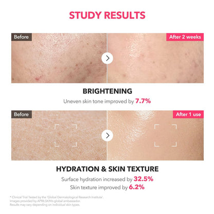 APRILSKIN TXA+Niacinamide 99 Pink Milky Toner | 99% High-Purity TXA 3% + Niacinamide 5% for Brightening | Highly Concentrated Cream Toner | Deep Moisturizing Formula for Dull Skin | 5.07 fl.oz.
