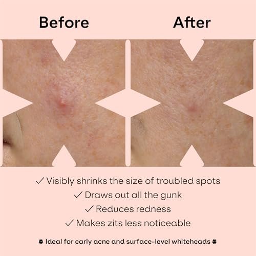 ZVYK Pimple Patches Cute for Face (28 Unique Acne Patch Designs) | Hydrocolloid, Salicylic Acid, Tea Tree | Strong Adhesion, Waterproof, Vegan | Confidence Patch Be You - görsel 8