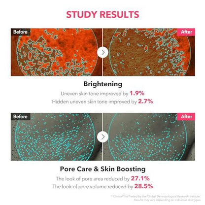 APRILSKIN TXA Niacinamide Toning Shot 99 Spicule Facial Serum - Brightening & Pore Care, 1.01 fl. oz.