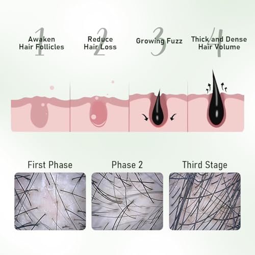 Gypsophila Batana Oil Hair Growth Bundle - Batana Oil Shampoo & 100% Pure Natural Rosemary Hair Treatment for Women & Men – Thicker, Healthier Hair Avelisse