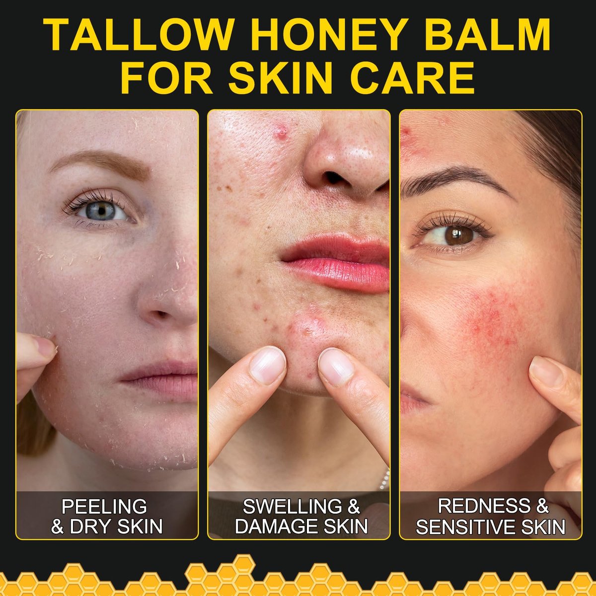 KZUO Beef Tallow for Skin - Hydrating Tallow Balm with Raw Honey and Beeswax, Grass-Fed Beef Tallow & Raw Wild Honey Blend, Body & Face Moisturizer, Natural Formula, 4.2 Fl Oz Avelisse