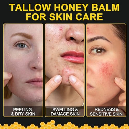 KZUO Beef Tallow for Skin - Hydrating Tallow Balm with Raw Honey and Beeswax, Grass-Fed Beef Tallow & Raw Wild Honey Blend, Body & Face Moisturizer, Natural Formula, 4.2 Fl Oz Avelisse