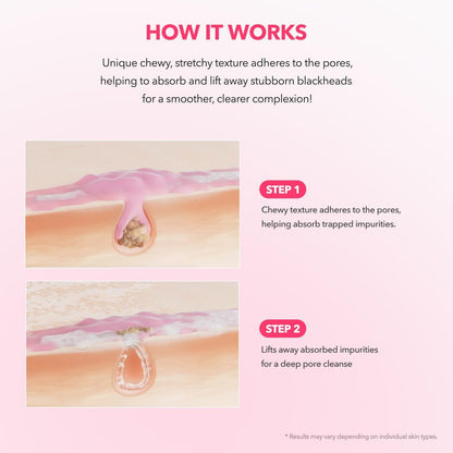 APRILSKIN TXA Niacinamide 99 Pore Care Pink Bubble Gum Deep Cleanser - 99% High-Purity TXA+Niacinamide All-in-One Cleanser for Deep Cleansing, Blackhead Care, Pore Care, Moisturizing - 4.23 fl.oz.
