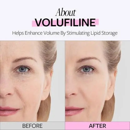 RE:CIPE Volufiline 100% Ampoule – Pure Volufiline Serum from Sederma France, DIY Skin Care Booster for Face & Body, Hydrating & Age-Defying Formula (0.33 fl oz) Avelisse