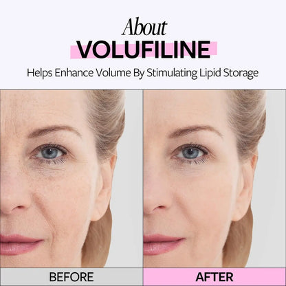 RE:CIPE Volufiline 100% Ampoule – Pure Volufiline Serum from Sederma France, DIY Skin Care Booster for Face & Body, Hydrating & Age-Defying Formula (0.33 fl oz) Avelisse