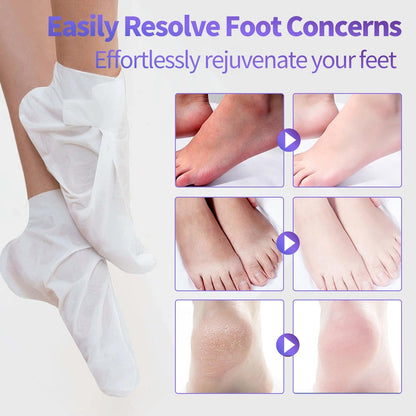 18 Pack Moisturizing Foot Mask – Hydrating Foot Masks for Dry Cracked Feet | CRISTALBOX Avelisse