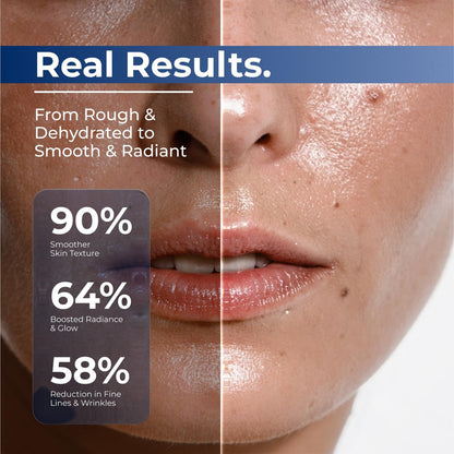 TURMSKIN Hyaluronic Acid Serum Ampoules [Ultra Hydrating Vials] – 3% Hyaluron Booster for Glass Skin & Anti-Aging – 24-Hour Hydration – Triple Hyaluronic Complex for Face Skin Repair & Renew Avelisse