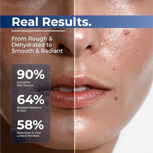 TURMSKIN Hyaluronic Acid Serum Ampoules [Ultra Hydrating Vials] – 3% Hyaluron Booster for Glass Skin & Anti-Aging – 24-Hour Hydration – Triple Hyaluronic Complex for Face Skin Repair & Renew Avelisse