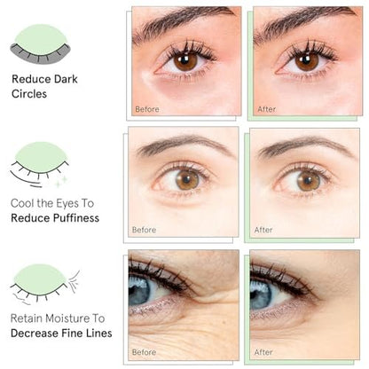 QUIA Hydrogel Eye Patches with Collagen – Depuff, Smooth Fine Lines & Hydrate in 15 Minutes – No-Slip, Soothing Formula – 20 Pairs for All Skin Types Avelisse