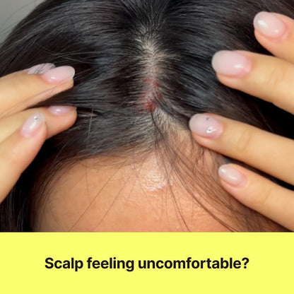 CHUNGMIJUNG Itchy Scalp Shampoo for Sensitive Scalp – Gentle Sulfate Free Seaweed (Kelp) Shampoo with Laminaria Japonica & Mung Bean, Hydrating Korean Hair Care for Dry Hair, 16.9 fl oz / 500ml Avelisse