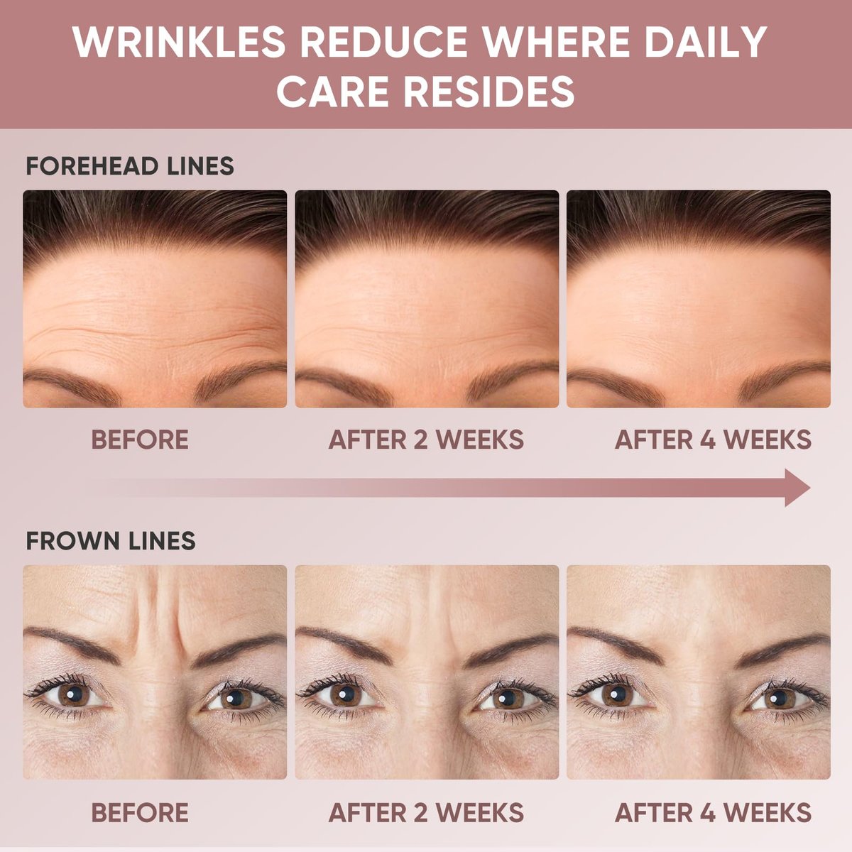 Chialing Forehead Wrinkle Patches – Reusable Overnight Smoothing Silicone Tape with Lavender Oil, Reduce Fine Lines & Prevent Creases, Non-Invasive Facial Pads, Pack of 4 Avelisse