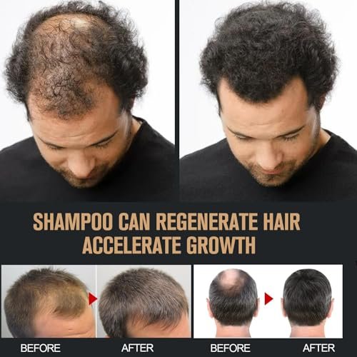 2 Pcs Root Activator Shampoo - Hair Growth Shampoo for Anti-Hair Loss, Natural Formula for Men and Women Avelisse