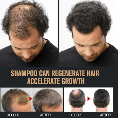 2 Pcs Root Activator Shampoo - Hair Growth Shampoo for Anti-Hair Loss, Natural Formula for Men and Women Avelisse