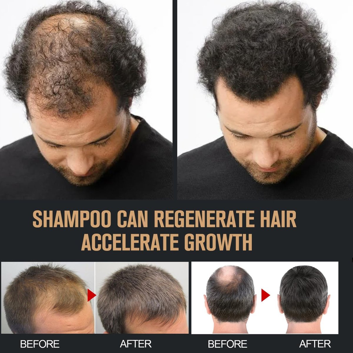 2 Pcs Root Activator Shampoo - Hair Growth Shampoo for Anti-Hair Loss, Natural Formula for Men and Women Avelisse